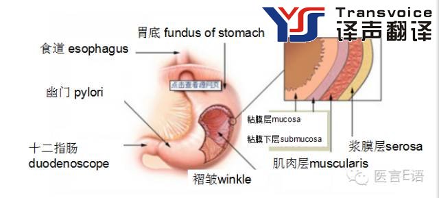 医学翻译：消化科——胃癌(图2)